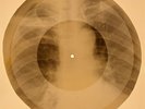 X-RAY USSR ROENTGEN BONES RECORD 78 rpm ORIGINAL OLD RIBS 657