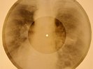 X-RAY USSR ROENTGEN BONES RECORD ORIGINAL OLD RIBS 661