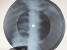 LED ZEPPELIN SINCE I'VE BEEN X-Ray USSR Record Roentgen Bones Ribs Music Vinyl