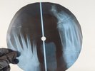 DAVID BOWIE MAN WHO SOLD THE W X-Ray USSR Record Roentgen Bones Ribs Music Vinyl