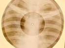 X-RAY USSR ROENTGEN BONES RECORD ORIGINAL OLD RIBS 692