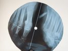 DAVID BOWIE CHANGE X-Ray USSR Record Roentgen Ribs Bone Music Vinyl