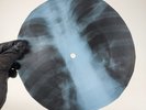 LED ZEPPELIN LEMON SONG X-Ray USSR Record Roentgen Bone Ribs Music Vinyl