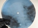 DAVID BOWIE ALL THE MADMEN X-Ray USSR Record Roentgen Bone Ribs Music Vinyl