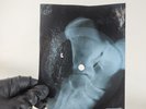 LED ZEPPELIN IMMIGRANT SONG X-Ray USSR Record Roentgen Bones Ribs Music Vinyl