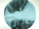 DOORS LIGHT MY FIRE X-Ray USSR Record Roentgen Bones Ribs Music Vinyl