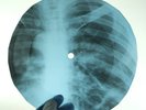 LED ZEPPELIN BRING IT ON HOME X-Ray USSR Record Roentgen Bones Ribs Music Vinyl
