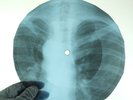 LED ZEPPELIN LEMON SONG X-Ray USSR Record Roentgen Bones Ribs Music Vinyl
