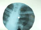 BEATLES LUCY IN THE SKY X-Ray USSR Record Roentgen Bones Ribs Music Vinyl