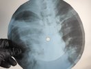 LED ZEPPELIN DAZED&CONFUSED X-Ray USSR Record Roentgen Bone Ribs Music Vinyl
