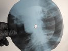 LED ZEPPELIN MOBY DICK X-Ray USSR Record Roentgen Bone Ribs Music Vinyl