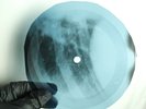 BUFFALO SPRINGFIELD DOWN TO THE X-Ray USSR Record Roentgen Bone Ribs Music Vinyl
