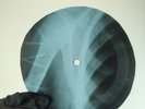 BEATLES TICKET TO RIDE X-Ray USSR Record Roentgen Bone Ribs Music Vinyl
