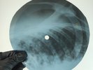 ROLLING STONES POISON IVY X-Ray USSR Record Roentgen Bone Ribs Music Vinyl