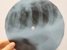 LED ZEPPELIN MOBY DICK X-Ray USSR Record Roentgen Bone Ribs Music Vinyl