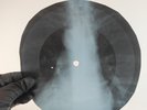 LED ZEPPELIN WHOLE LOTTA LOVE X-Ray USSR Record Roentgen Bone Ribs Music Vinyl