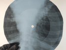 LED ZEPPELIN DAZED & CONFUZED X-Ray USSR Record Roentgen Bone Ribs Music Vinyl