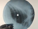 LED ZEPPELIN MOBY DICK X-Ray USSR Record Roentgen Bone Ribs Music Vinyl