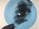 LED ZEPPELIN OUT OF TITLES X-Ray USSR Record Roentgen Bone Ribs Music Vinyl