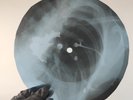 LED ZEPPELIN SINCE IVE BEEN LOV X-Ray USSR Record Roentgen Bone Ribs Music Vinyl