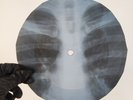 VELVET UNDERGROUND I FOUND A RE X-Ray USSR Record Roentgen Bone Ribs Music Vinyl