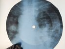 LED ZEPPELIN MOBY DICK X-Ray USSR Record Roentgen Bone Ribs Music Vinyl