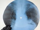 LED ZEPPELIN BABY I'M GONNA LEA X-Ray USSR Record Roentgen Bone Ribs Music Vinyl