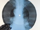 LED ZEPPELIN WHEN THE LEVEE BRE X-Ray USSR Record Roentgen Bone Ribs Music Vinyl