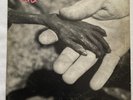 Dead Kennedys – Plastic Surgery Disasters LP 1982 1st Pressing – VIRUS27 RARE