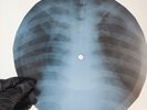 LED ZEPPELIN SINCE IVE BEEN LOV X-Ray USSR Record Roentgen Bone Ribs Music Vinyl