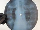 LED ZEPPELIN BATTLE OF EVERMORE X-Ray USSR Record Roentgen Bone Ribs Music Vinyl