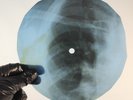 LED ZEPPELIN MOBY DICK X-Ray USSR Record Roentgen Bone Ribs Music Vinyl
