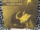 AGORAPHOBIC NOSEBLEED 7