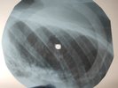 ROLLING STONES POISON IVY X-Ray USSR Record Roentgen Bone Ribs Music Vinyl