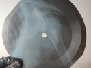LED ZEPPELIN FRIENDS X-Ray USSR Record Roentgen Bone Ribs Music Vinyl