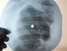 FOUR TOPS BERNADETTE X-Ray USSR Record Roentgen Bone Ribs Music Vinyl