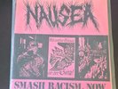 Nausea - Smash Racism . Now EP 7