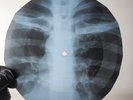 VELVET UNDERGROUND ROCK & ROLL X-Ray USSR Record Roentgen Bone Rib Music Vinyl