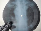 BEATLES ACROSS THE UNIVERCE X-Ray USSR Record Roentgen Bone Ribs Music Vinyl